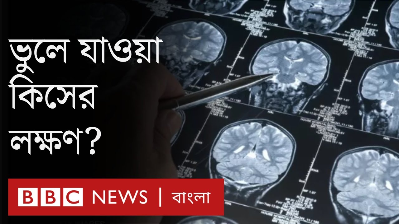 Alzheimer's disease: ভুলে যাওয়া রোগটি কেন হয়, স্মৃতি হারানোর সাথে পার্থক্য কী? | Dementia