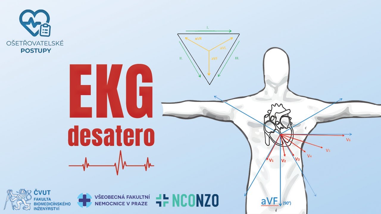🇨🇿 (CZ) | EKG 3/4| DESATERO | OŠETŘOVATELSKÉ POSTUPY