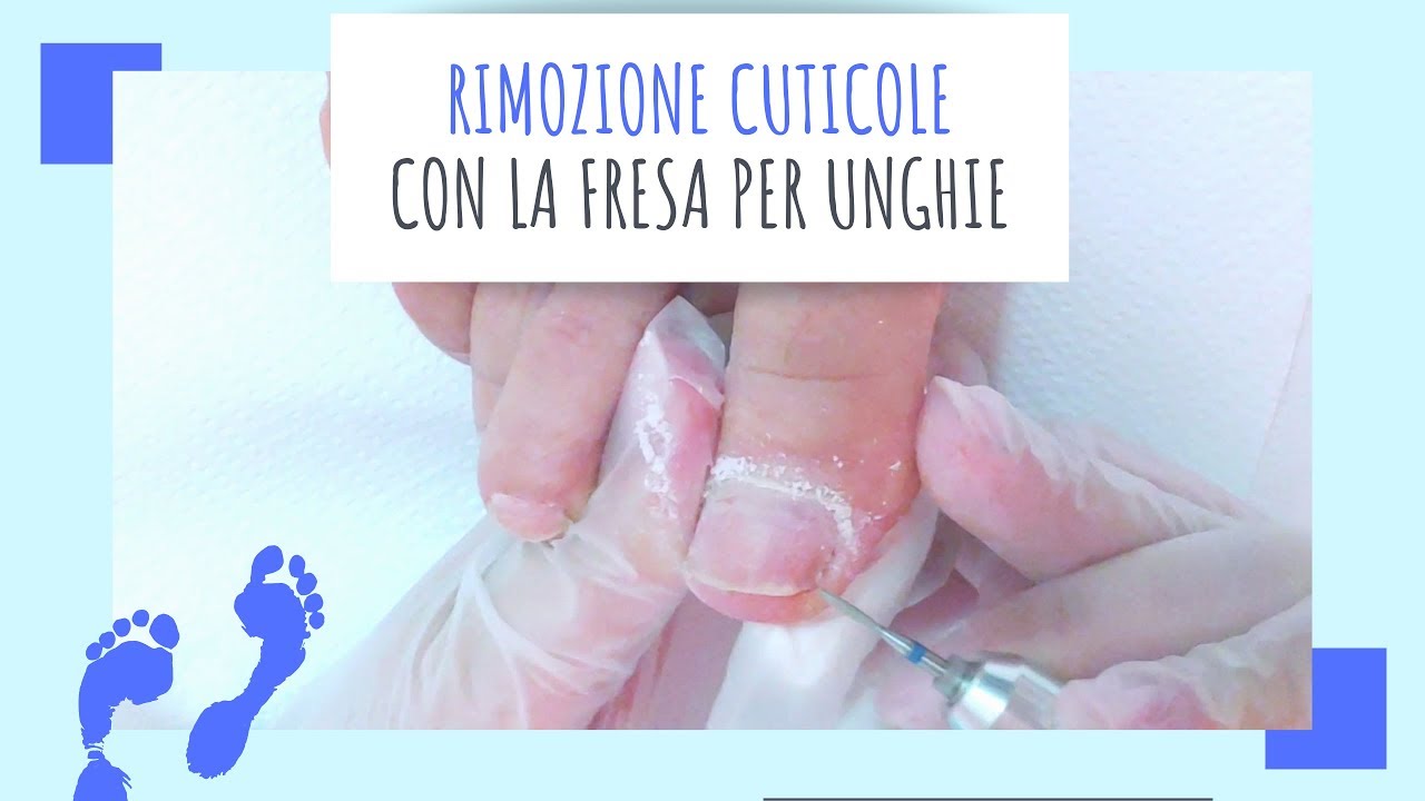 Rimozione cuticole con la fresa per unghie | PEDICURE ESTETICO