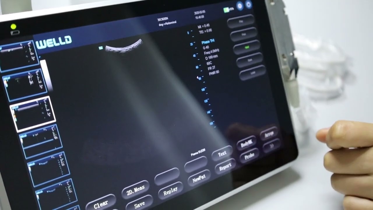 P10 Operation