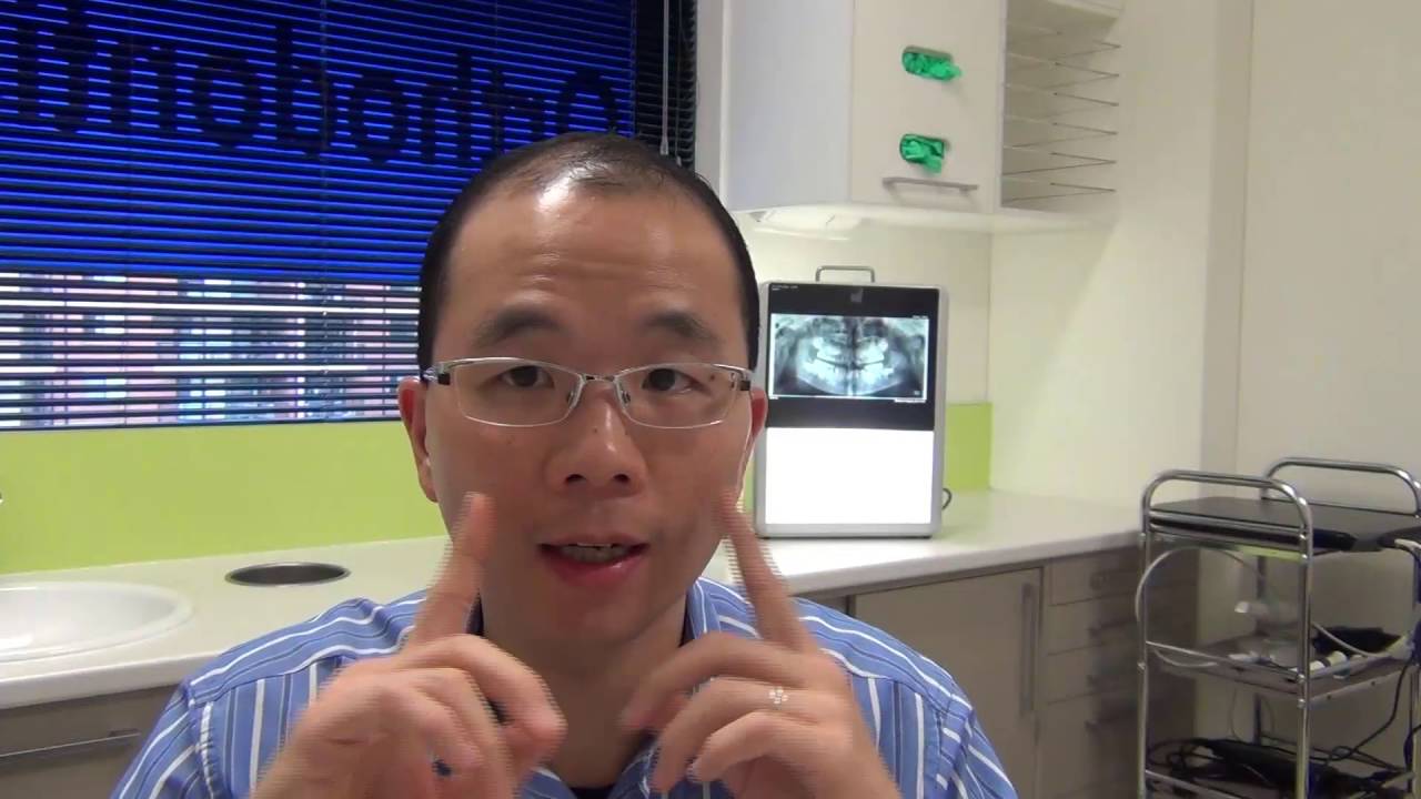 Narrow Upper Jaws And When To Start Orthodontic Treatment