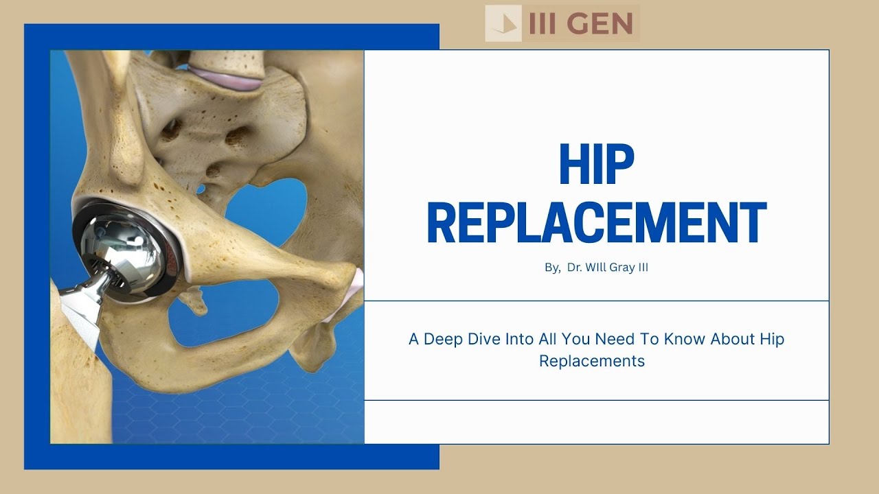 Hip Replacement: Deep Dive Into All You Need To Know About Hip Replacements
