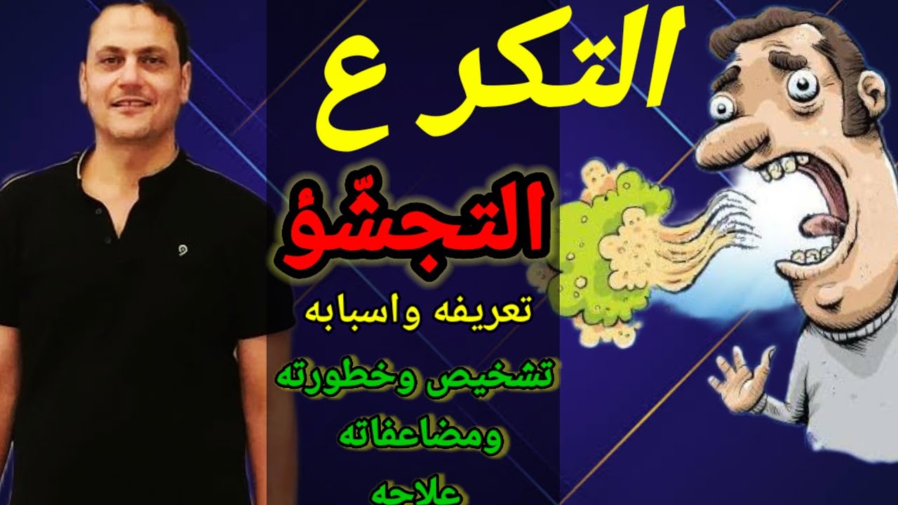 التكرع او التجشّؤ | أسباب | أعراض | علاج | #دكتور_محمود_الشربيني