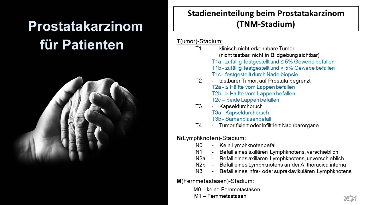 Prostatakarzinom für Patienten - Tumorstadien | Prof. Hilke Vorwerk