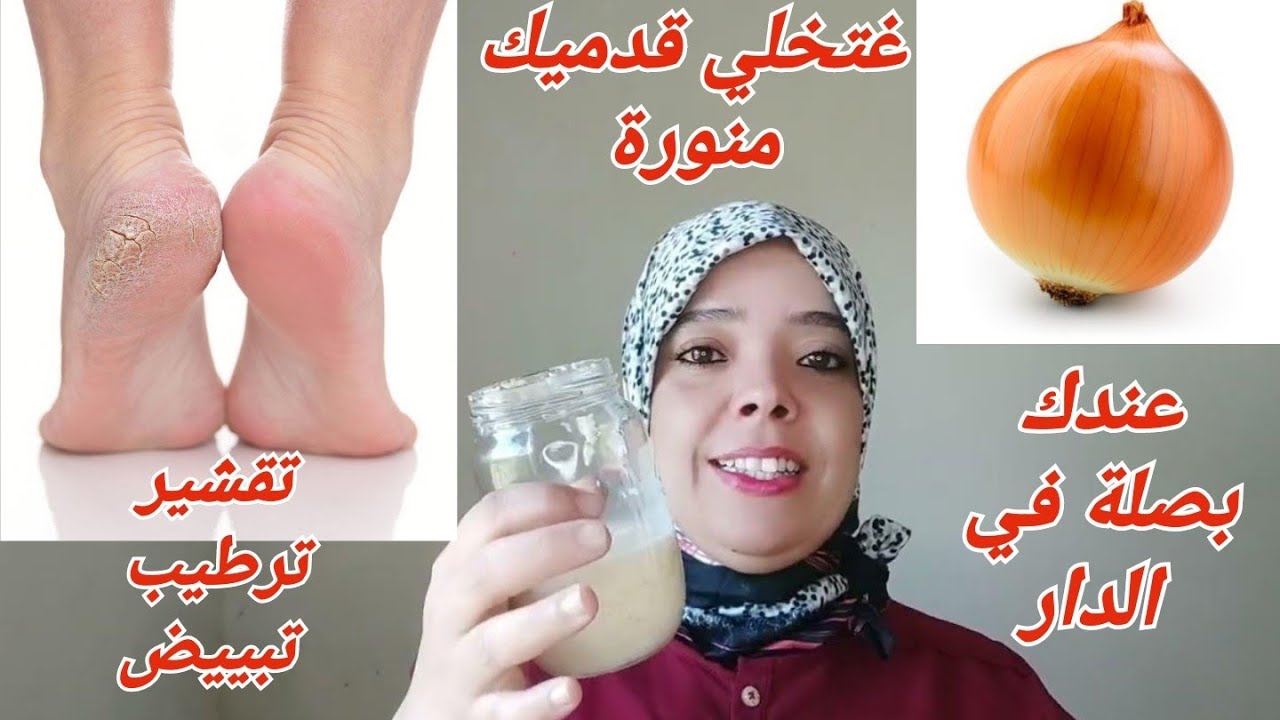 باي باي تشققات القدمين واليدين والنتيجة من أول استعمال ترطيب وتبييض رااائع. اقدام مثل الأطفال
