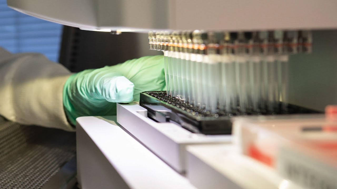 FDA approves Alzheimer&rsquo;s drug debated by experts