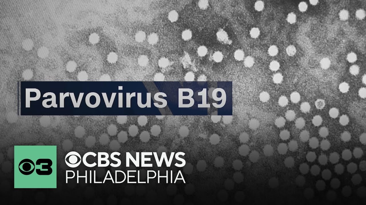 CDC issues new warning about increasing cases of Parvovirus B19