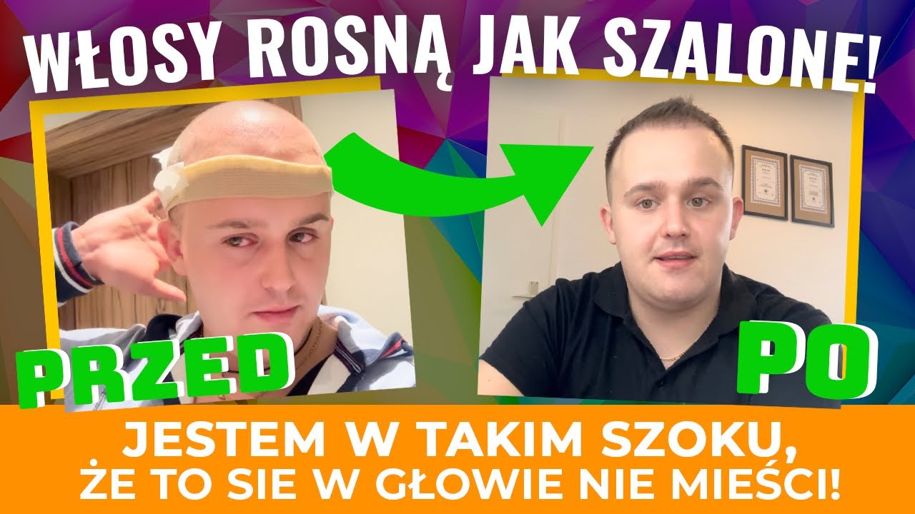 CUDA PO KTÓRYCH WŁOSY ROSNĄ JAK SZALONE❗️