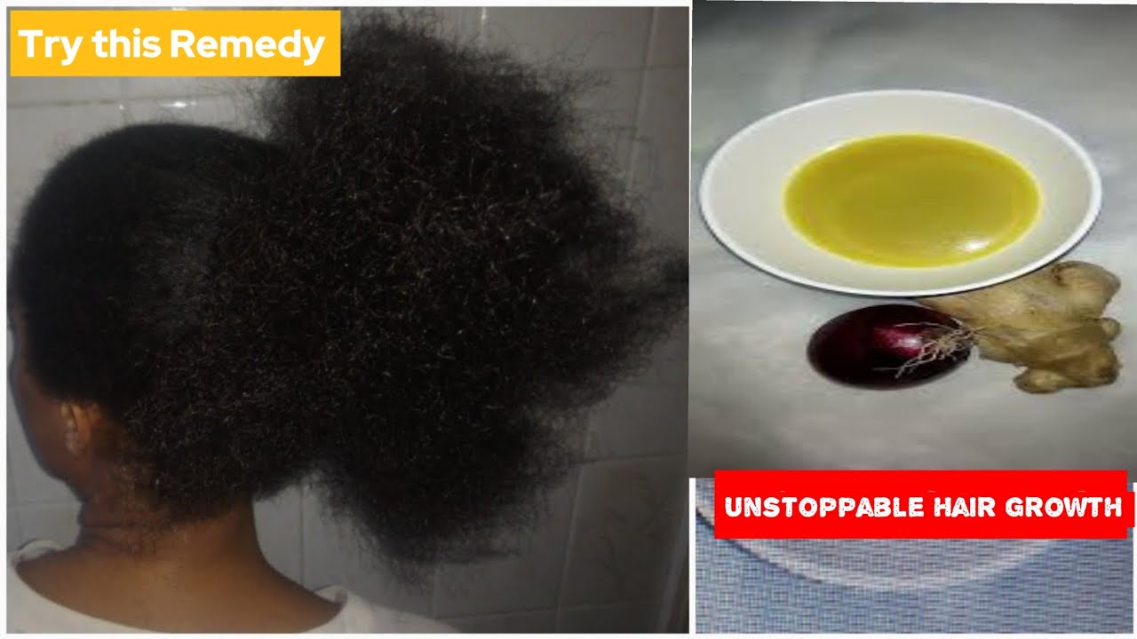 How I Use Ginger and Onion For Unstopable Hair Growth | 4C Hair | Natural Hair