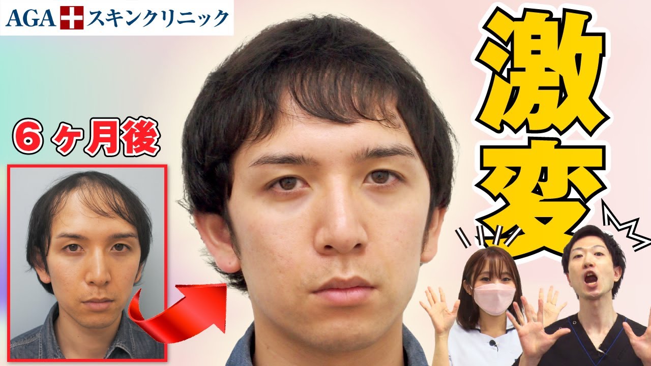 【衝撃】ドクターも驚いたAGA治療ビフォーアフター7選