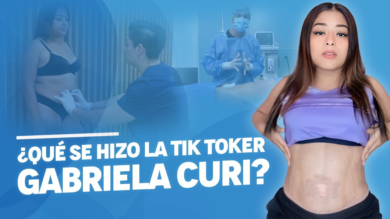 OPERAMOS A LA TIKTOKER GABRIELA CURI ¿Qué se hizo?