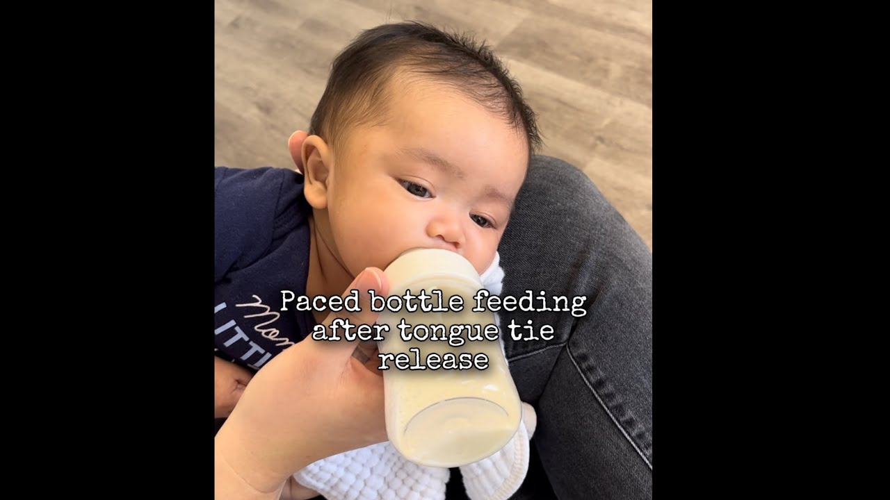 Paced bottle feeding after tongue tie release