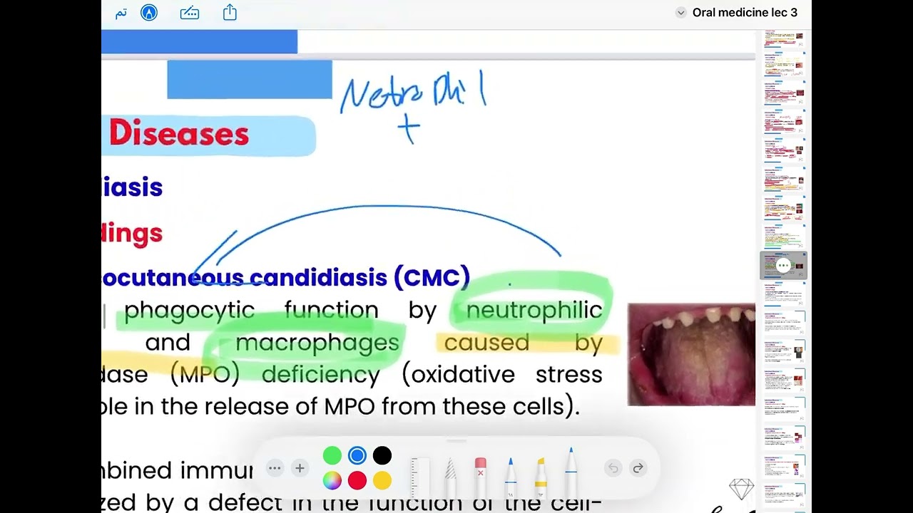 Oral medicine 5th lec 3 Red and white lesion of oral mucosa ( part 2) 💙