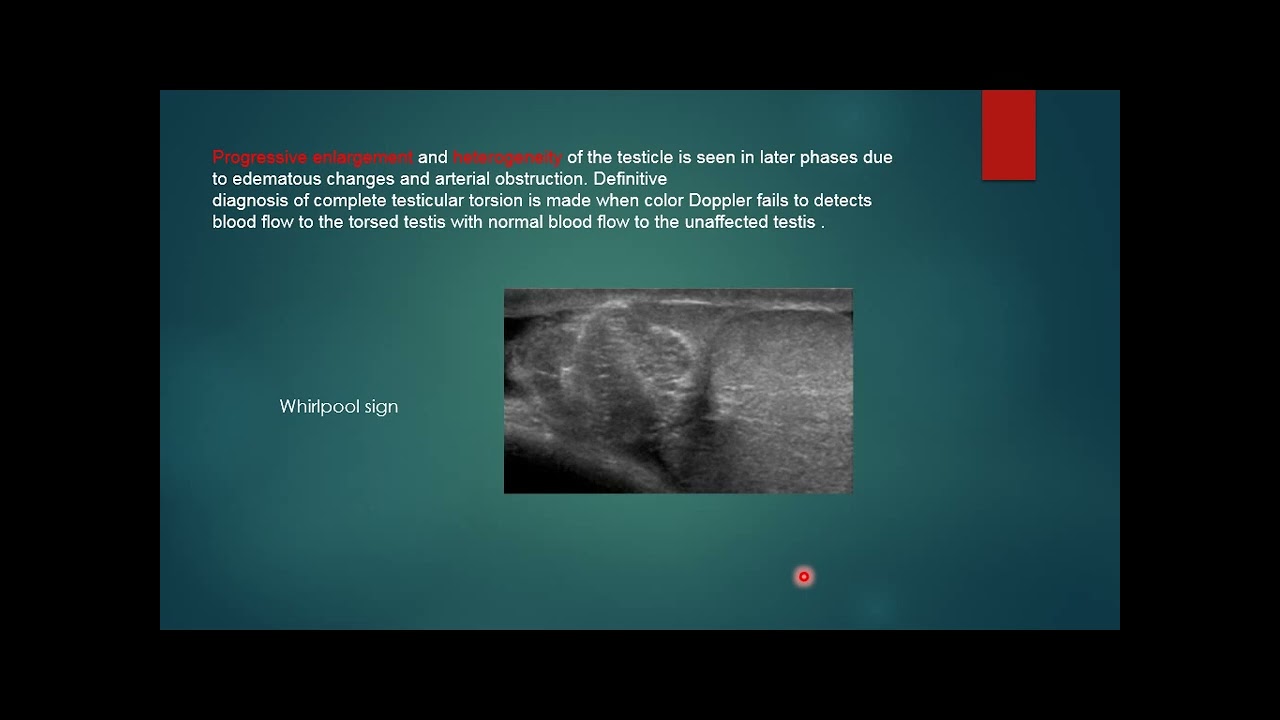 scrotal swelling in adults