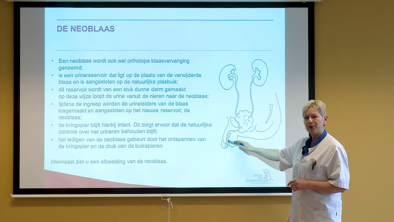 Cystectomie blaaskanker
