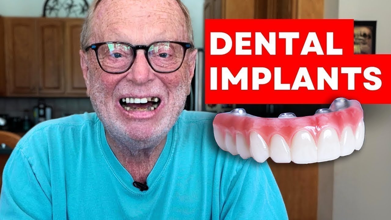 Permanent Teeth in 24 Hours | Why I Traveled For Dental Implants
