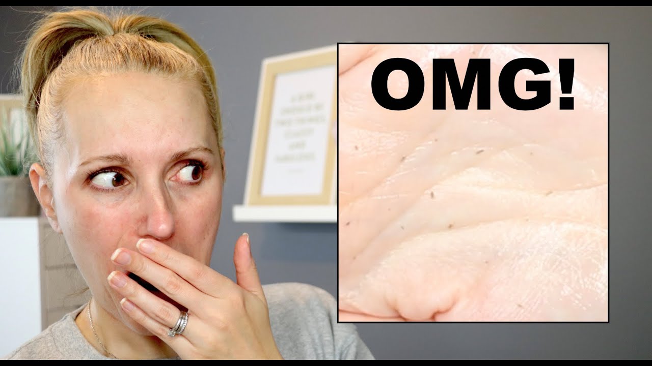 15 MINUTE OIL CLEANSING ROUTINE - WHAT ON EARTH JUST CAME OUT OF MY SKIN?!
