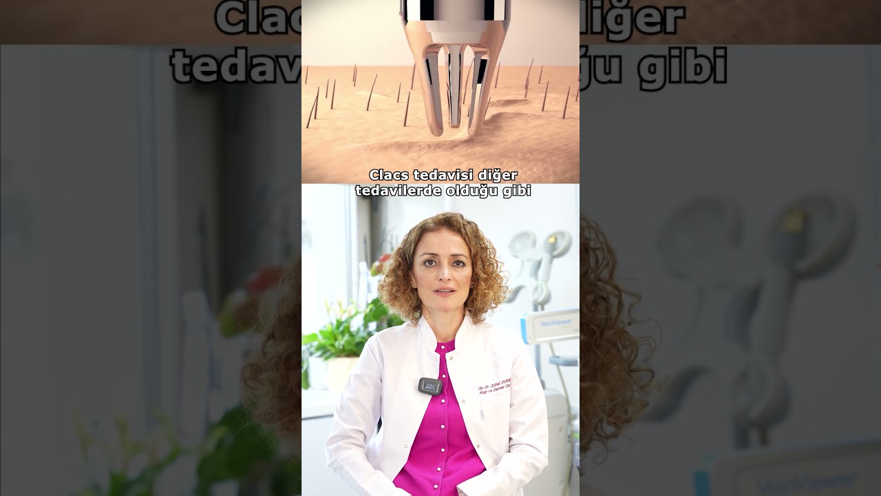 1 Seans CLACS&rsquo;te Damar Tamamen Kaybolur mu? Hayır! #clacs #varistedavisi