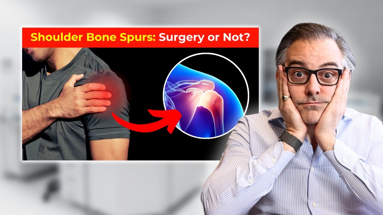 Shoulder Bone Spurs: Causes, Treatments & When to See a Doctor | @PeterDeNobleMD Explains