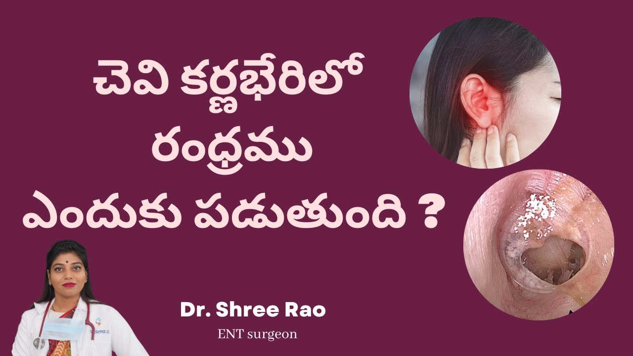 చెవి కర్ణభేరిలో రంధ్రము ఎందుకు పడుతుంది?  | Causes for ear drum hole - Dr. Shree C Rao