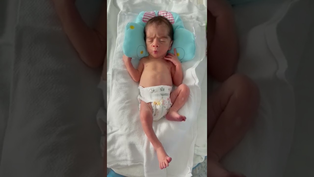 Vídeo 4  2 wks 34 wks ga