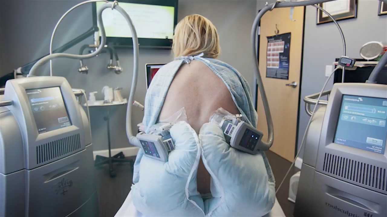 MEN are the Latest Patients for Non-Surgical Fat Removal!
