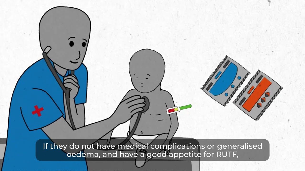 Management of Acute Malnutrition