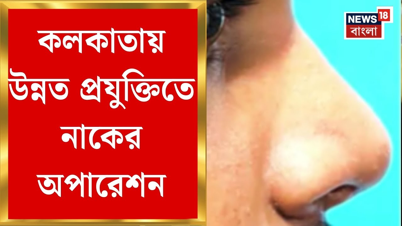 Kolkata News | নাক নিয়ে খুঁত খুঁত, রক্তপাত ছাড়াই নাক নিখুঁত এবার কলকাতায় | Bangla News