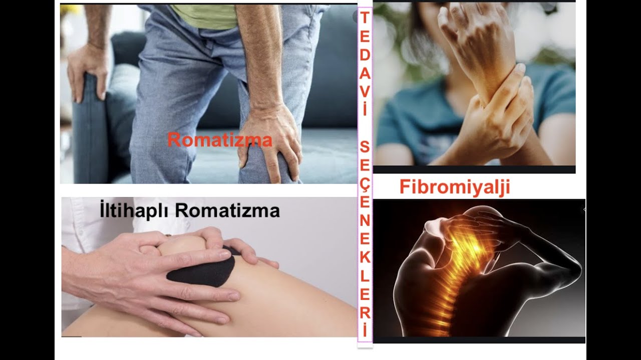 Romatizma, İltihaplı Romatizma, Fibromiyalji  Cesitleri ve Tedavisi