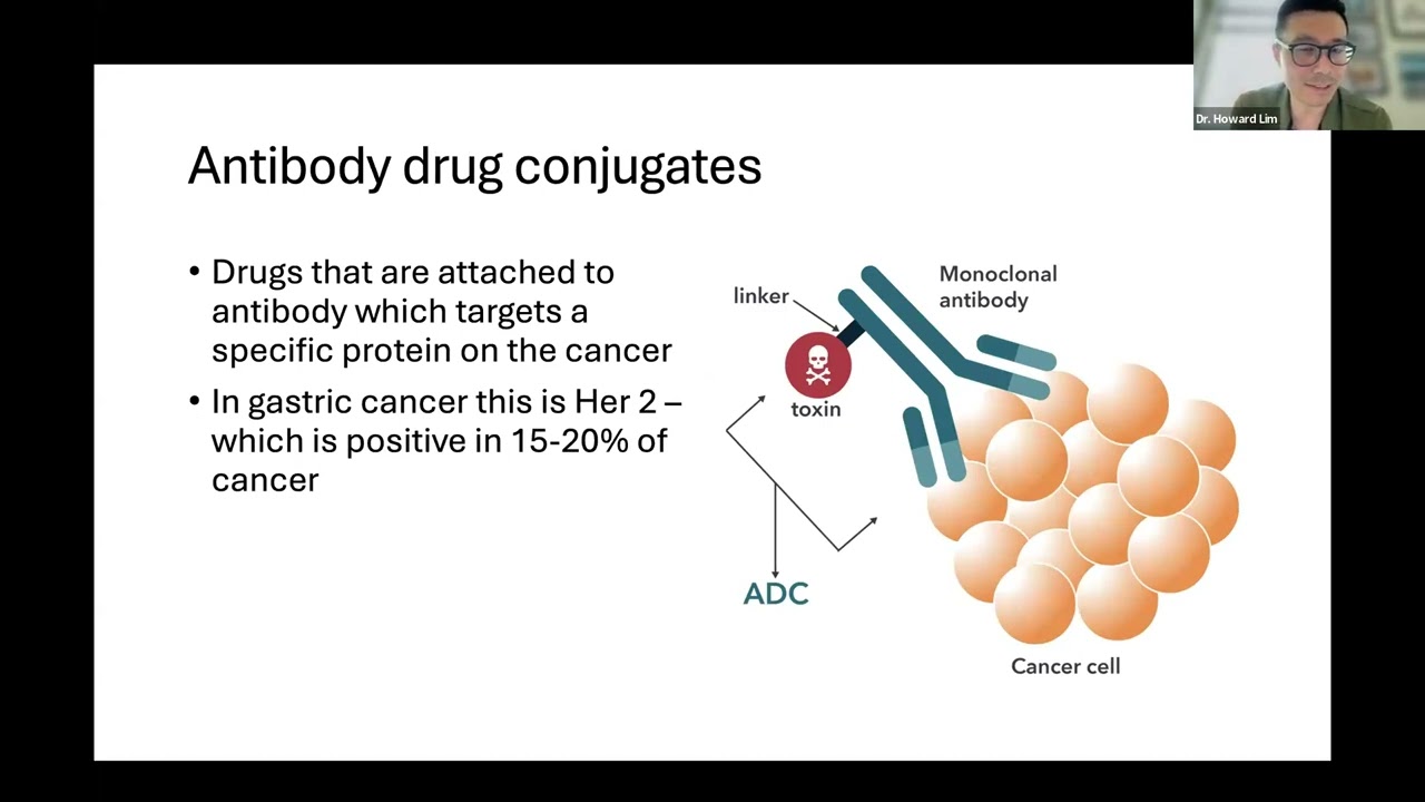 Stomach Cancer Webinar: IGCC + ASCO + ESMO GI 2025 Review