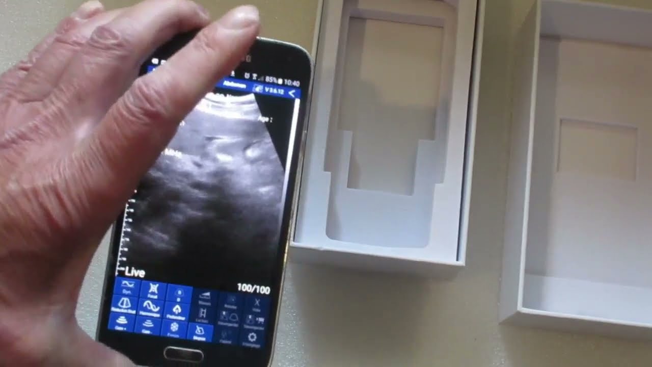 sonde echographique wifi convexe et telephone