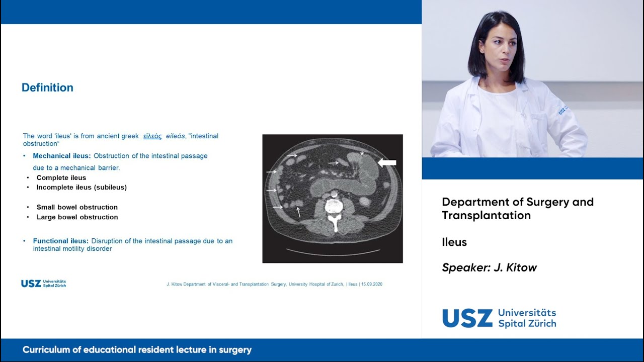 Ileus &ndash; Please participate in our 3-minute survey below!