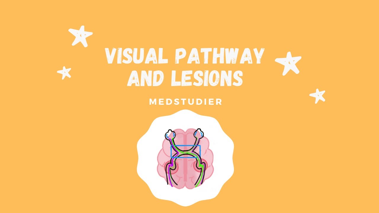 Visual Pathway and Lesions | MedStudier