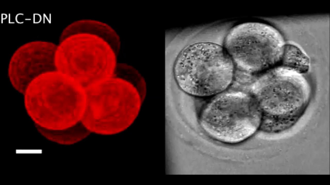Actomyosin polarisation through PLC-PKC triggers symmetry breaking of the mouse embryo