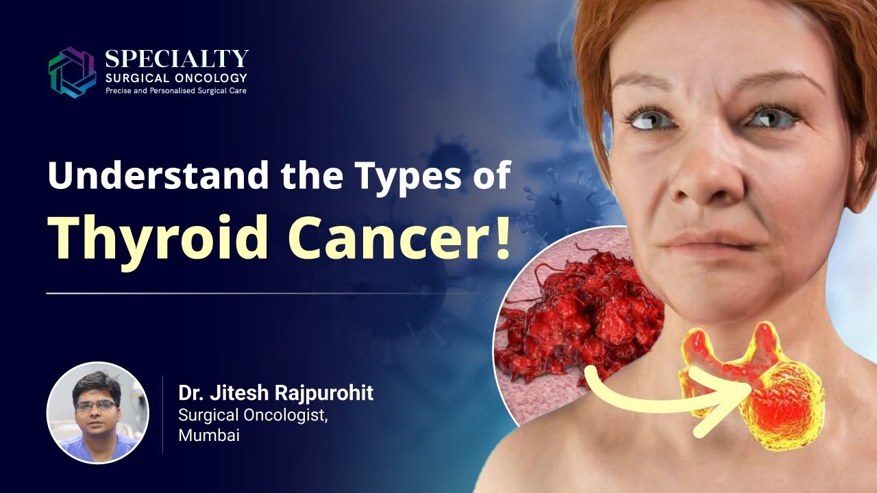 Different Types of Thyroid Cancer| Explore the Most Common Type | Dr Jitesh Rajpurohit, SSO