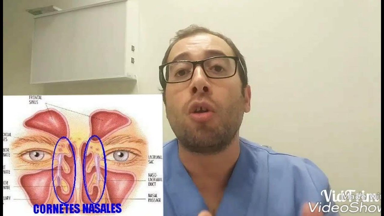 RINITIS, ADENOIDITIS. Por qué se TAPONAN LOS OÍDOS en los catarros.