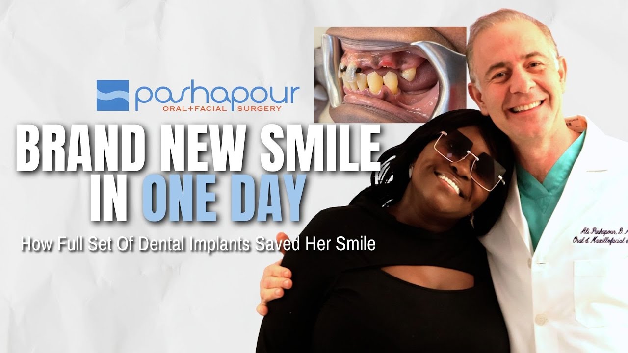 Teeth in One Day: How Dental Implants Gave Our Patient Her Confidence Back