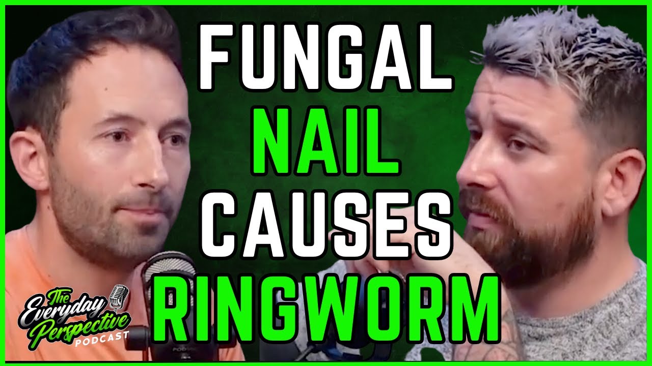 Doctor Explains How Athletes Foot & Fungal Nail Can Cause Ringworm | Everyday Perspective Clips