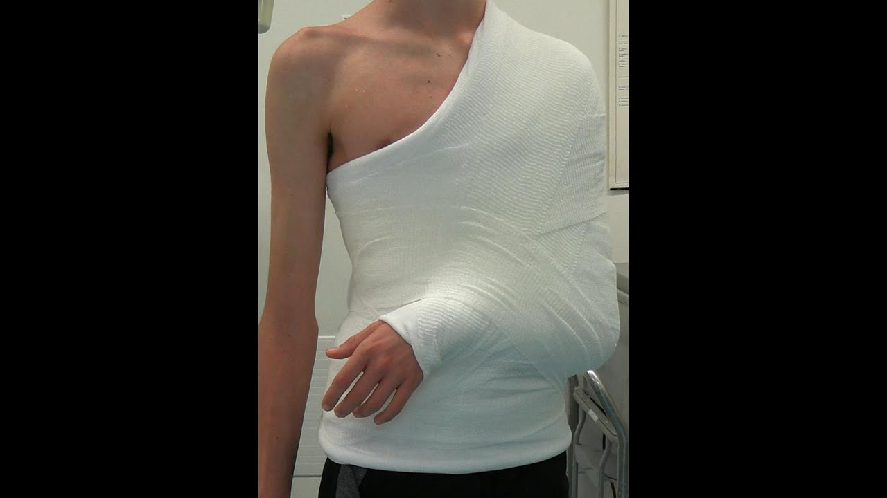 Desault Bandage Application