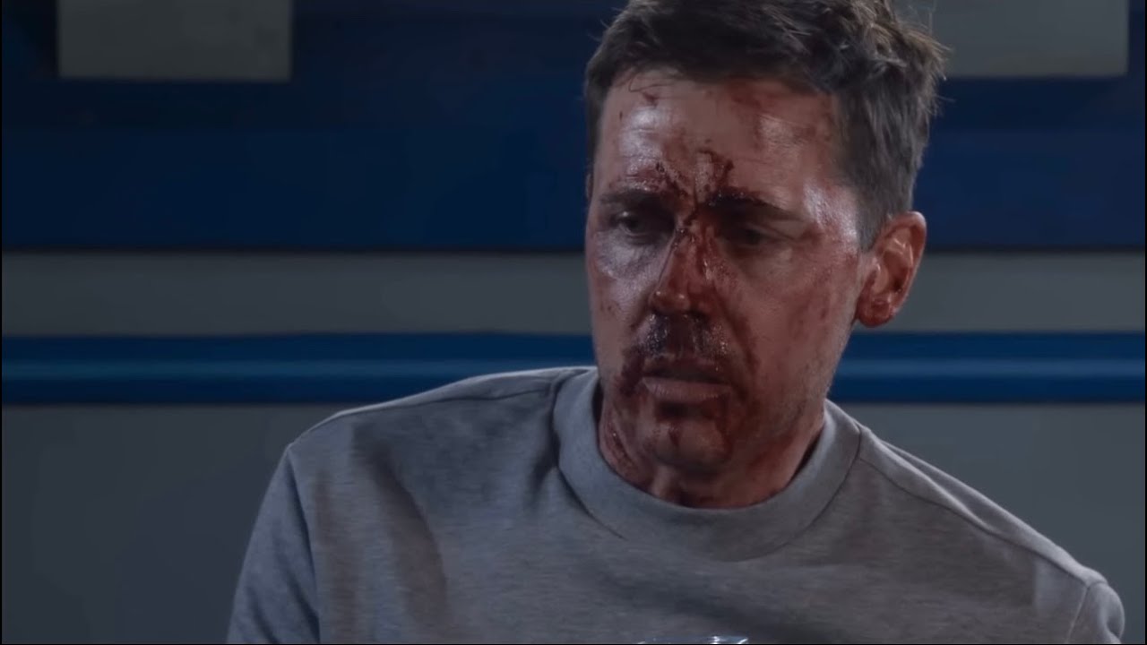 Coronation Street (Todd Goes Police/Hospital, Gary VS Theo, Theo Arrested) 15th April 2026