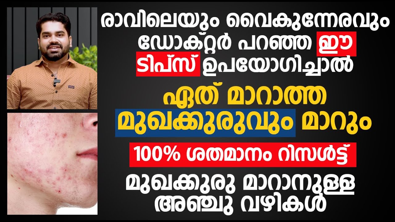 Mukhakkuru maran tips | മുഖക്കുരു ഒറ്റ രാത്രി കൊണ്ട് മാറാൻ How to remove pimples Naturally at home
