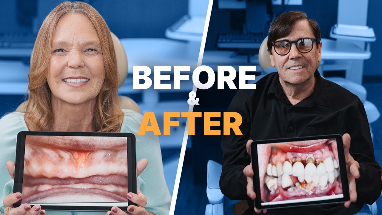 Incredible Smile Transformations &mdash; Check Out the Before and Afters