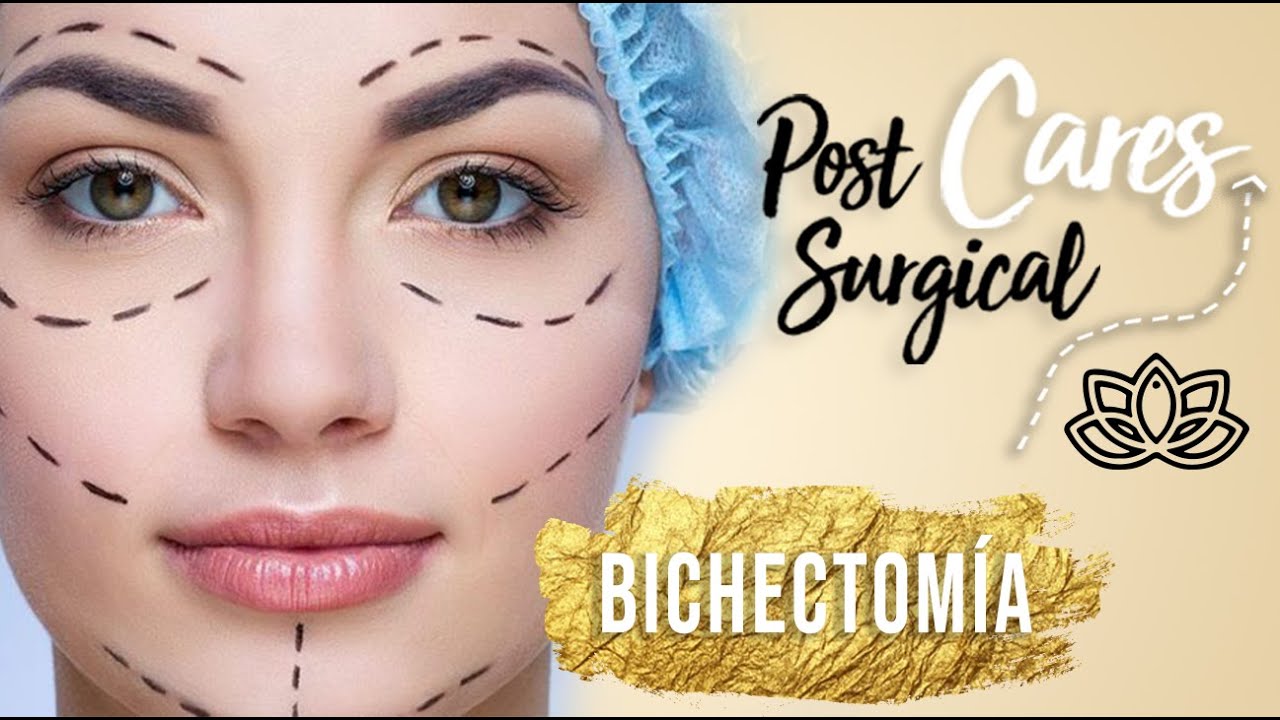 Cuidados Post Quirúrgicos: Bichectomía