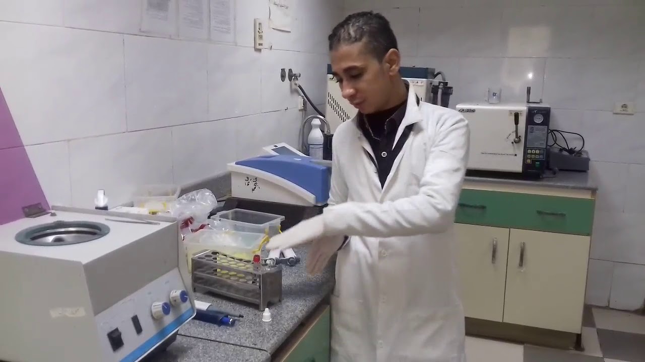 طريقة اجراء تحليل الكرياتنين مانيول Creattinin Analysis