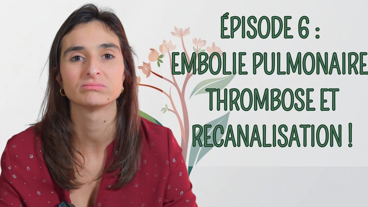 Épisode 6 : Embolie pulmonaire, thrombose et recanalisation ! - Mieux Vaut Prévenir Que Guérir 