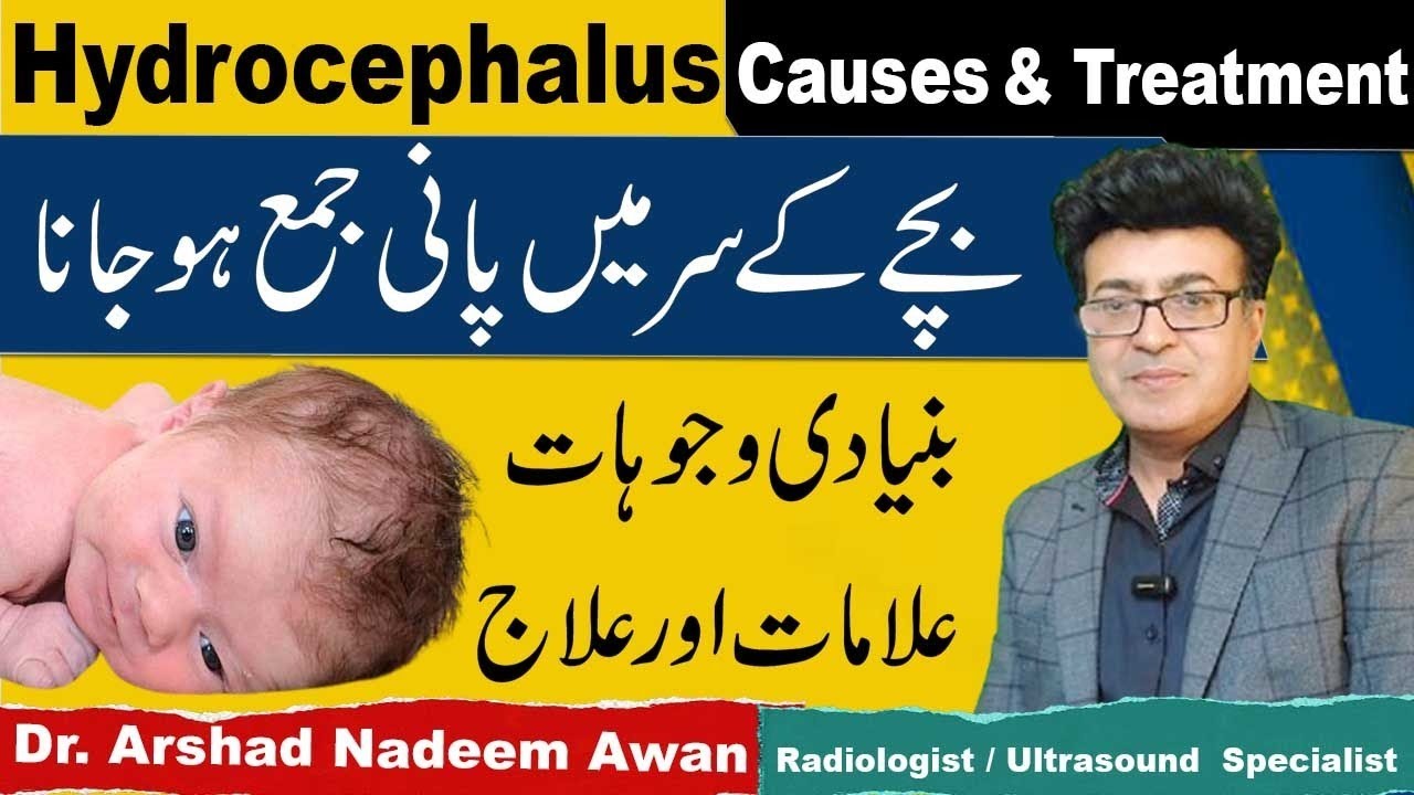 Hydrocephalus Causes,Symptoms And Treatment In Urdu