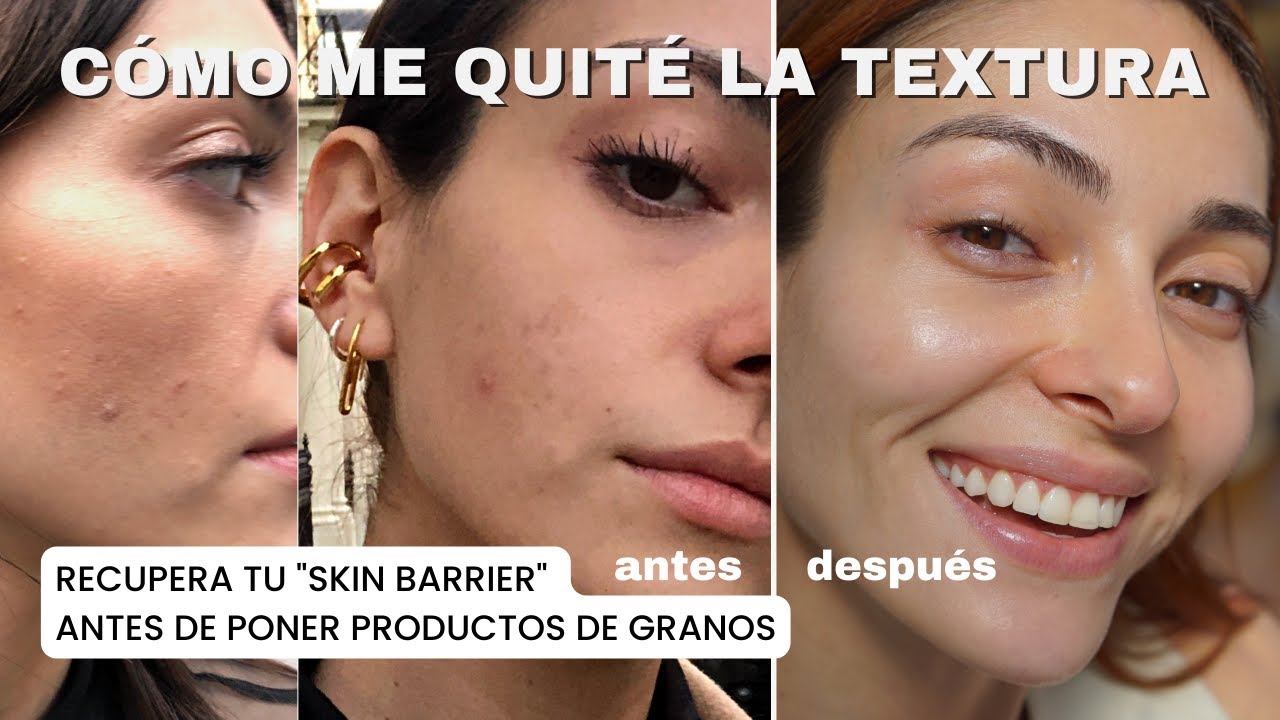 ¿Cómo quitar la textura de la piel? DETOX + RUTINA de skincare para eliminar textura | Anna Sarelly