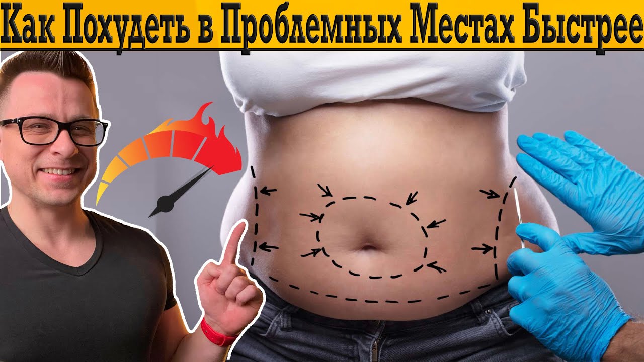 Диетолог отвечает - как быстро похудеть в проблемных местах!