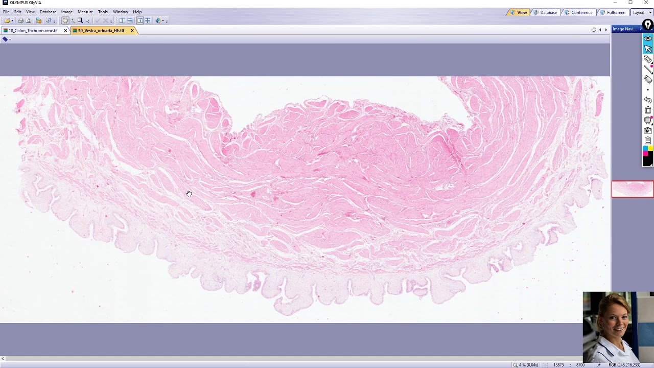 Vesica urinaria (močový mechýř)