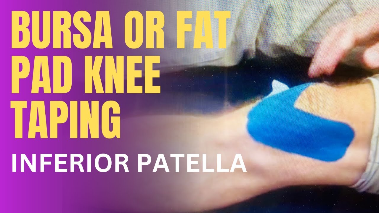 Bursa or Fat Pad Knee Taping